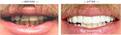 Four Ever Smile Dental Implant Center